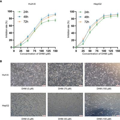 Dihydromyricetin functions as a tumor suppressor in hepatoblastoma by regulating SOD1/ROS pathway